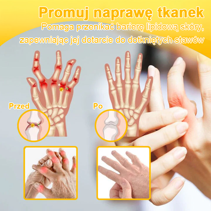 TLOPA® Toksyna botulinowa i jad pszczeli Krem przeciwbólowy do gojenia kości🐝🐝🐝