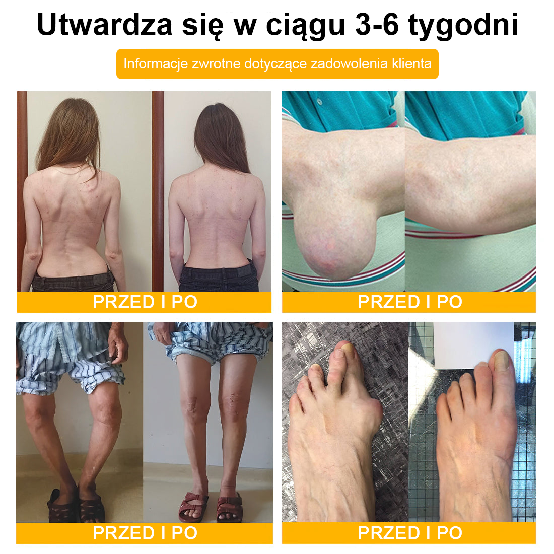 TLOPA® Toksyna botulinowa i jad pszczeli Krem przeciwbólowy do gojenia kości🐝🐝🐝