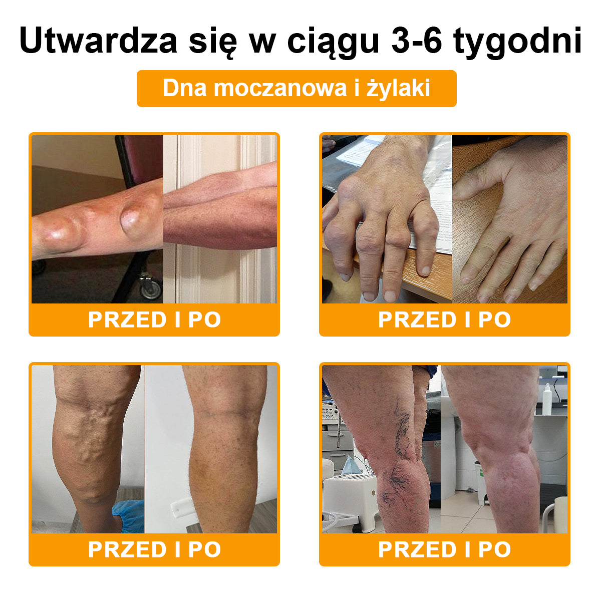 TLOPA® Toksyna botulinowa i jad pszczeli Krem przeciwbólowy do gojenia kości🐝🐝🐝