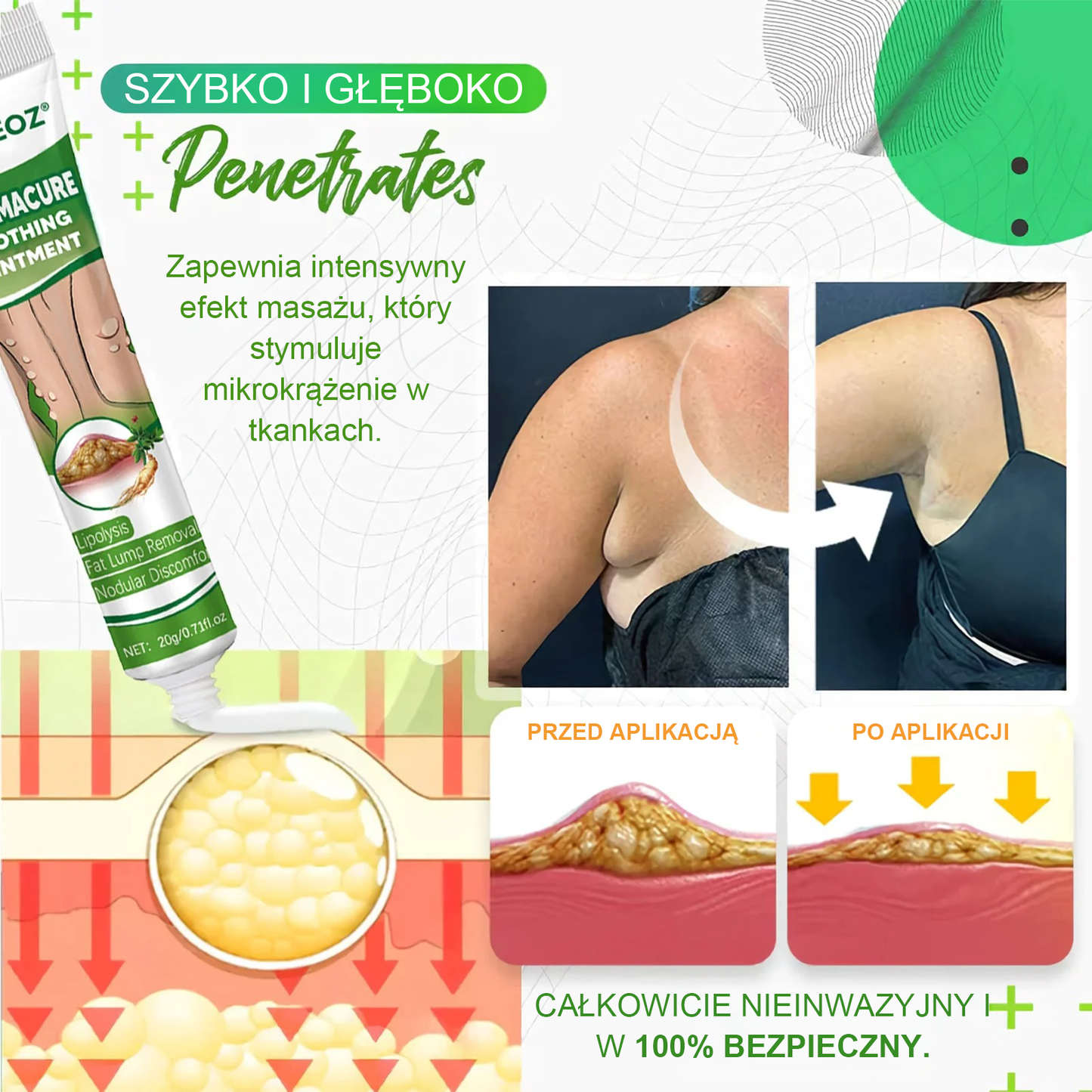 Maść łagodząca Cvreoz® Lipoma Cure