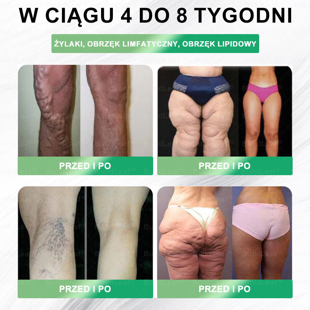 Oficjalny sklep Polska | ☘️☘️STDEI® GLP-1 8-w-1 Fit & Vital Rozwiązanie (Jednorazowe dziennie, widoczne zmiany w ciągu 7 dni) ✅ Otyłość, zdrowie sercowo-naczyniowe, cukrzyca, bezdech senny, zdrowie jelit, problemy ze stawami i inne