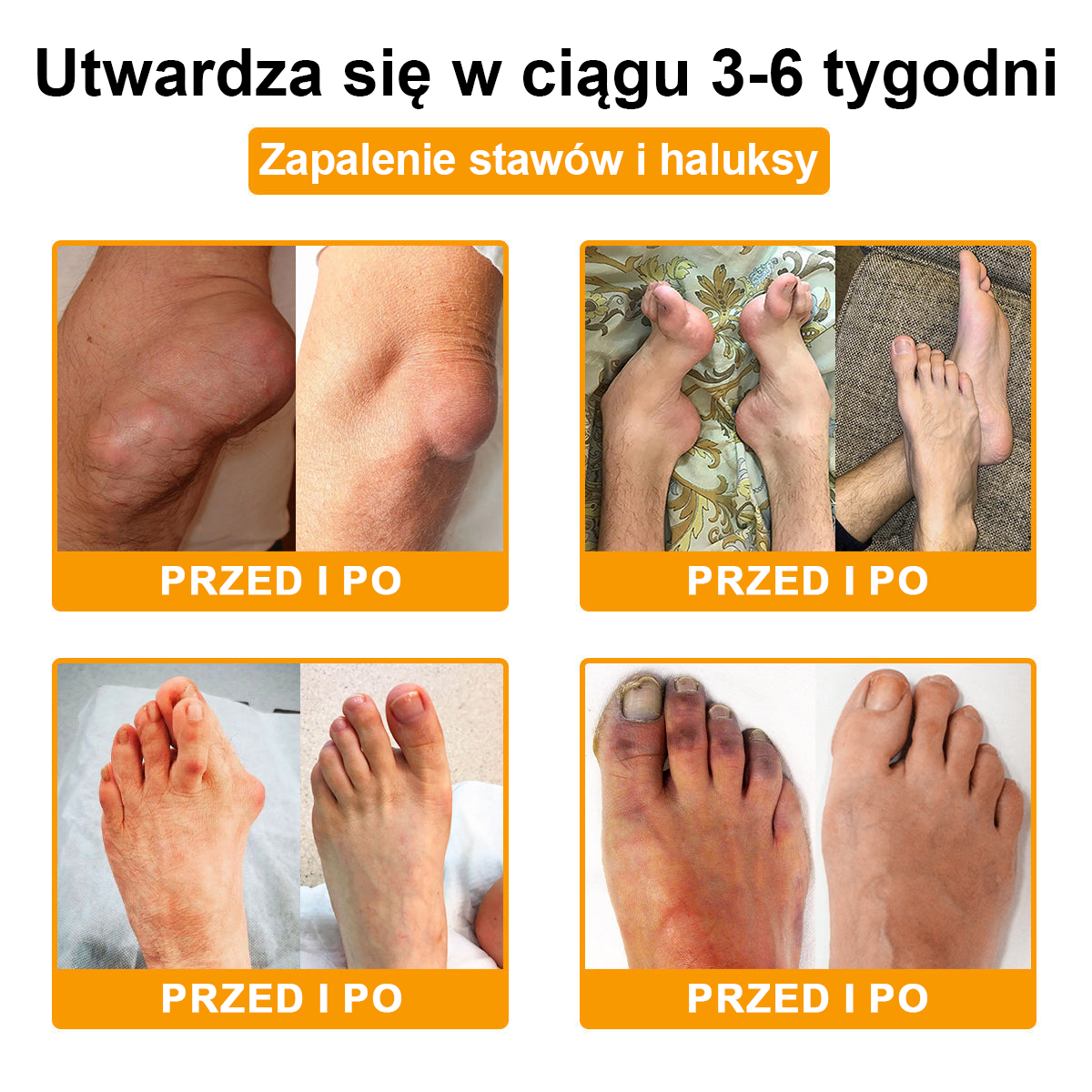 TLOPA® Toksyna botulinowa i jad pszczeli Krem przeciwbólowy do gojenia kości🐝🐝🐝