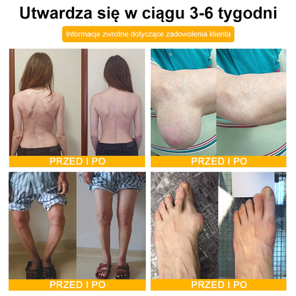TLOPA® Toksyna botulinowa i jad pszczeli Krem przeciwbólowy do gojenia kości🐝🐝🐝