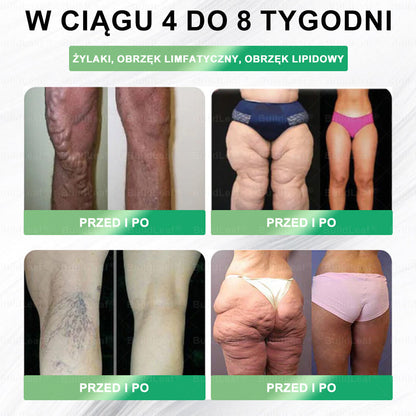 Oficjalny sklep Polska | ☘️☘️STDEI® GLP-1 8-w-1 Fit & Vital Rozwiązanie (Jednorazowe dziennie, widoczne zmiany w ciągu 7 dni) ✅ Otyłość, zdrowie sercowo-naczyniowe, cukrzyca, bezdech senny, zdrowie jelit, problemy ze stawami i inne